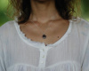 Every Mole Can Be Dangerous – Here’s How to Recognize Melanoma