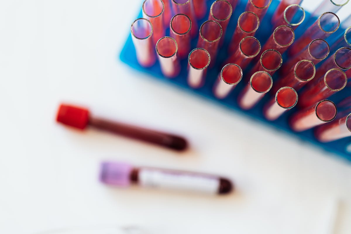 Scientists: People with This Blood Type Age More Slowly