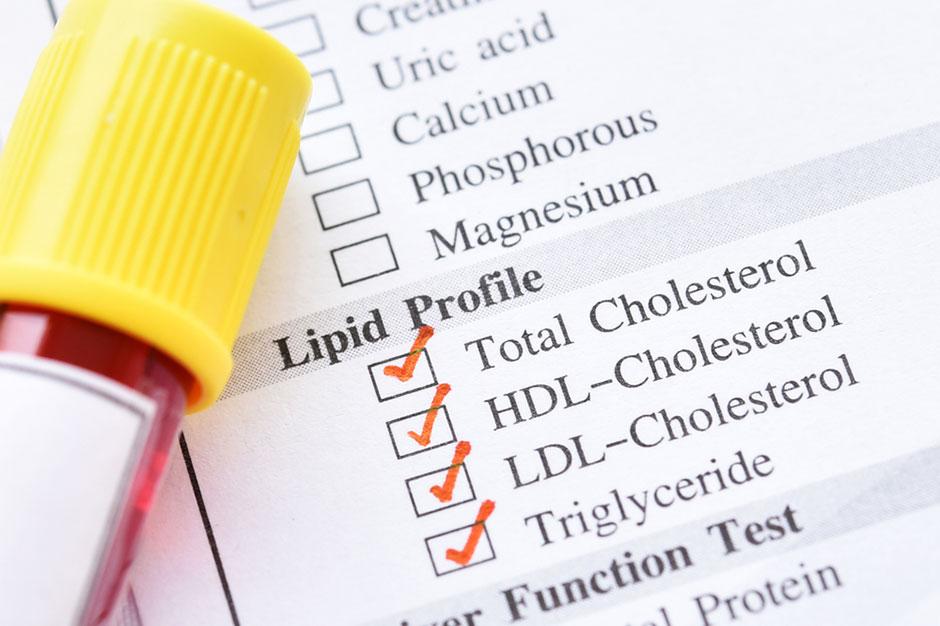Cholesterol Level Above Which Brain Disease Risk Increases